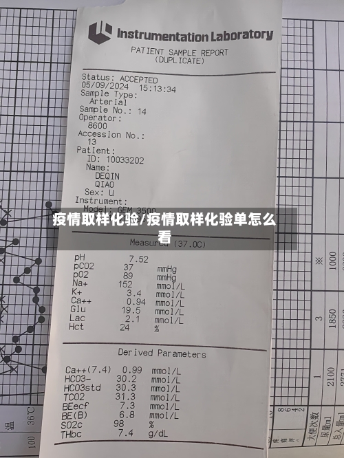 疫情取样化验/疫情取样化验单怎么看-第1张图片