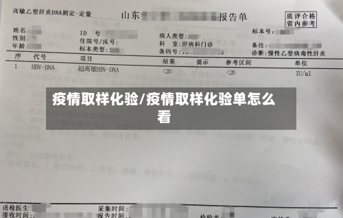 疫情取样化验/疫情取样化验单怎么看-第2张图片