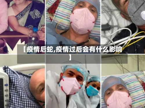 【疫情后蛇,疫情过后会有什么影响】-第2张图片