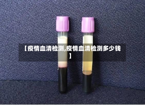【疫情血清检测,疫情血清检测多少钱】-第1张图片