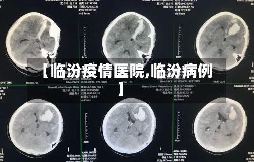 【临汾疫情医院,临汾病例】-第2张图片