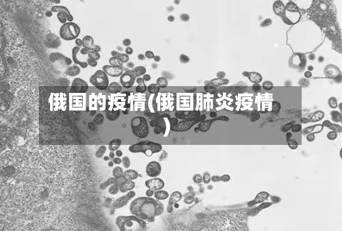 俄国的疫情(俄国肺炎疫情)-第1张图片