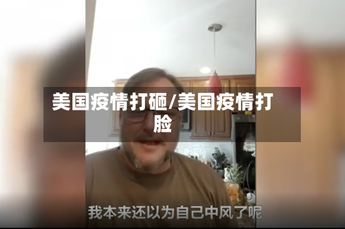 美国疫情打砸/美国疫情打脸-第3张图片