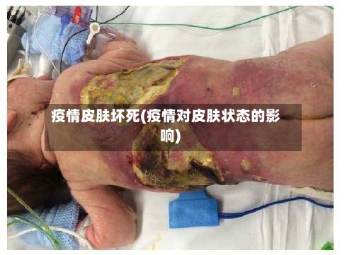 疫情皮肤坏死(疫情对皮肤状态的影响)-第1张图片