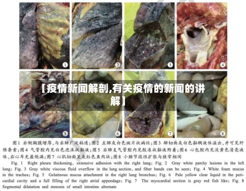 【疫情新闻解剖,有关疫情的新闻的讲解】-第1张图片