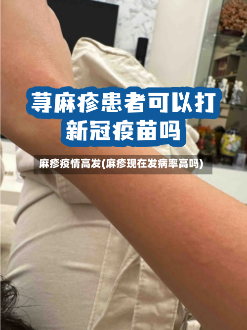麻疹疫情高发(麻疹现在发病率高吗)-第3张图片